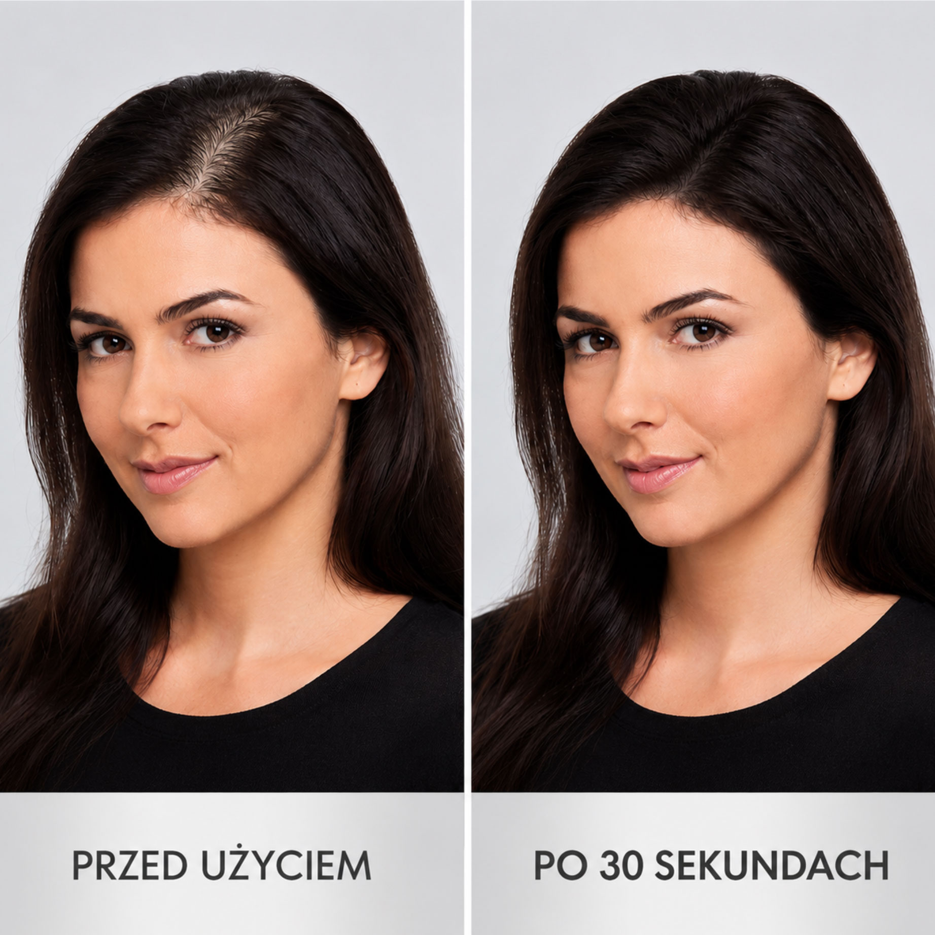 zagęszczanie przerzedzonych włosów Avenis przed i po
